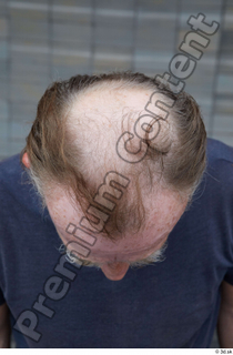 Street references  611 bald hair head 0003.jpg